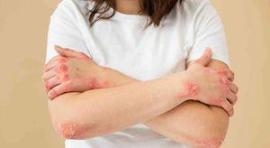 环境与食物污染损脏腑诱发敏感，中医排毒调理有法