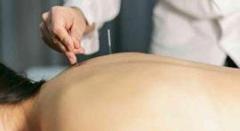 中医针灸：“针”启生命之门，见证垂危复苏与哲学启示