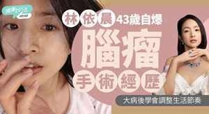 林依晨自爆脑瘤手术经历，大病后学会调整生活节奏