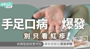 防疫警示｜肠病毒高峰期爆发！手足口病症状多变易误诊